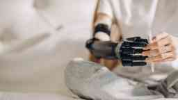 girl performing catching activities with a prosthetic limb