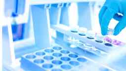 Scientist using protective robber gloves for handling substances and experiments